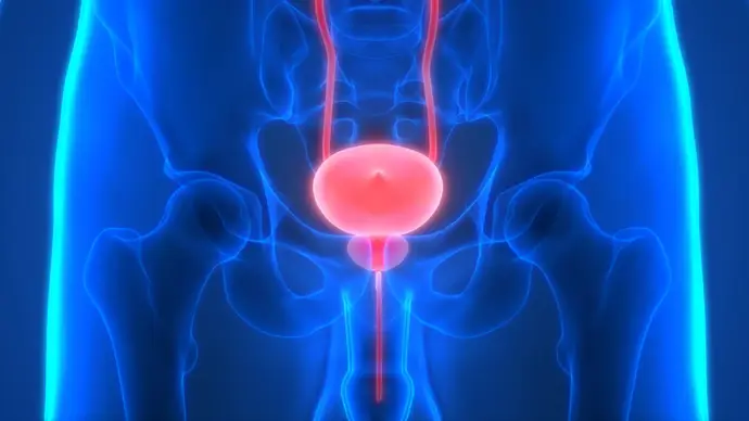 Células T mejoradas podrían revolucionar la inmunoterapia para el cáncer de próstata