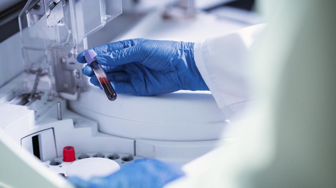 El hospital Ramón y Cajal obtiene un premio por su enfoque en pacientes tratados con terapia